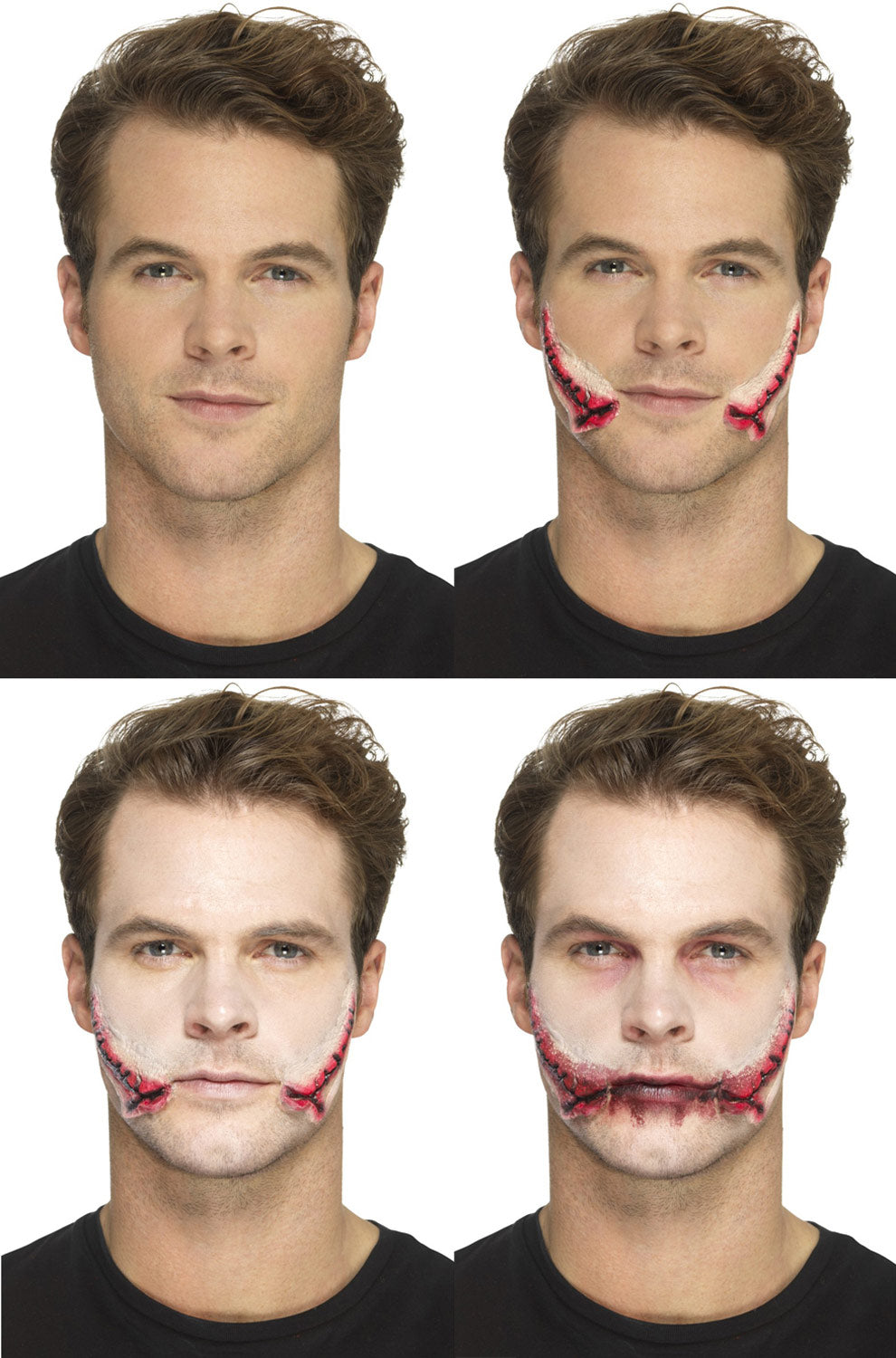 Stitched Smile Prosthetic